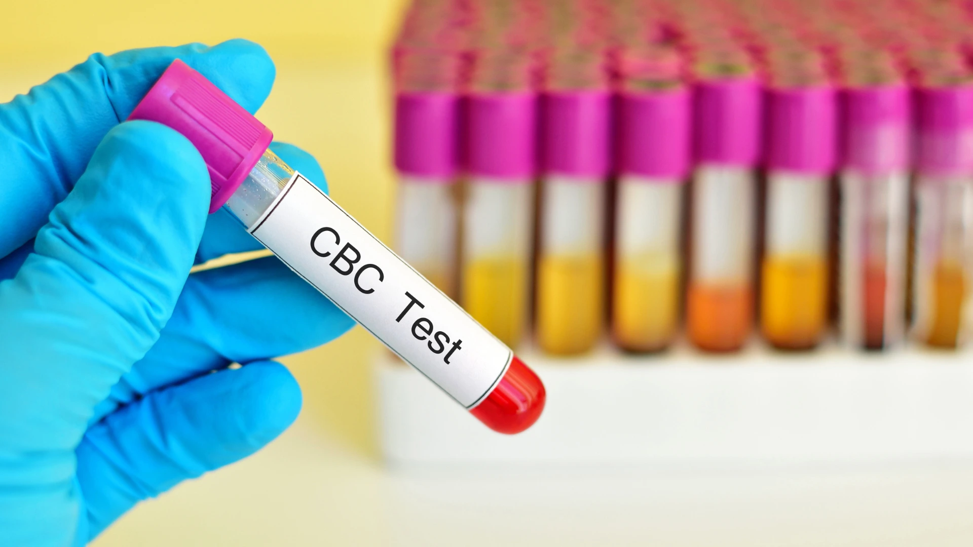 Complete Blood Count